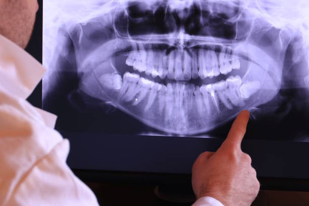 Best Emergency Dentist for Special Needs Patients in Meridian, TX