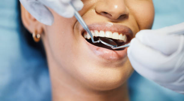 Best Emergency Dental Extractions in Meridian, TX