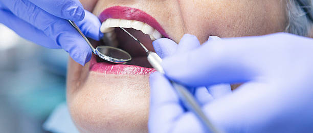 Best Weekend Emergency Dentist in Meridian, TX